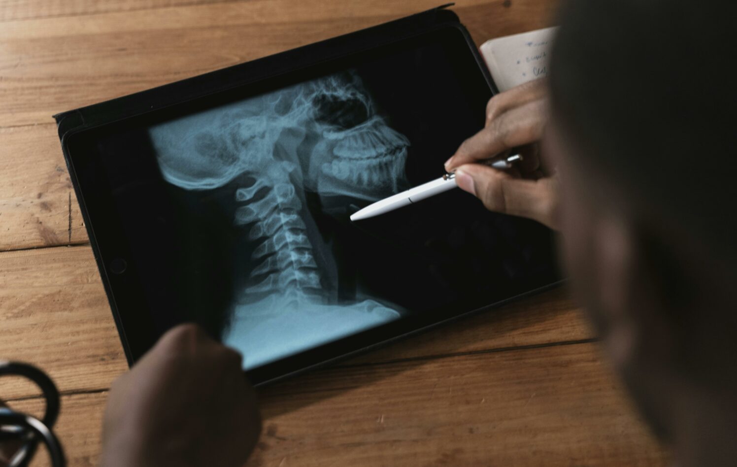 Person med en penn ved et røntgenbilde